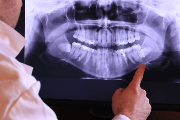 Best Emergency Treatment for Dental Infections or Abscesses in Gower, MO