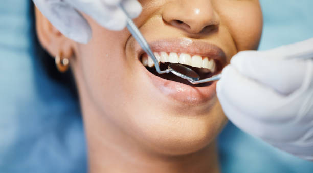 Best Emergency Dental Care for Broken or Chipped Teeth in Gower, MO